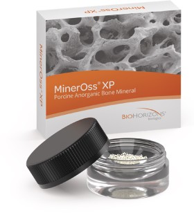 BioHorizons+Mineross+XP+Cortical-Cancellous