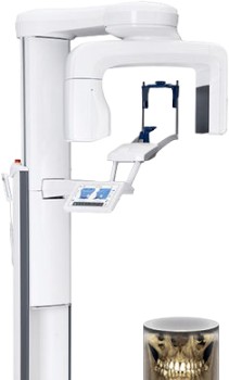 Redefine+Precision+with+Planmeca+Viso+G1